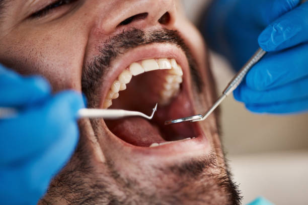 Best Emergency Denture Repair in St James, NC